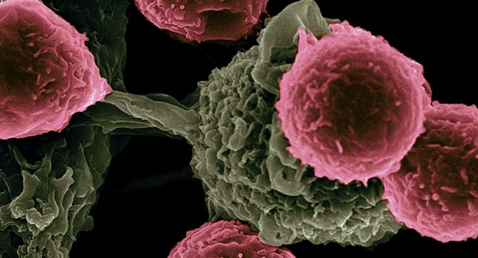 New targets found for diagnosing, treating aggressive cancers