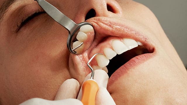 Ultrasound holds promise of accurate, risk-free diagnosis of dental disease