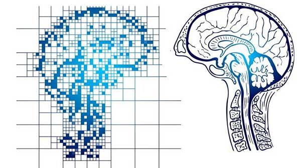 Key Alzheimer’s risk factors affect men more than women